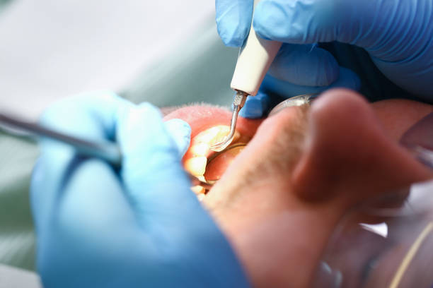Best Cosmetic Emergency Dentistry in Dobson, NC