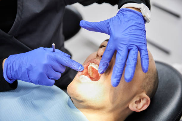 Best Emergency Dental Care for Broken or Chipped Teeth in Dobson, NC